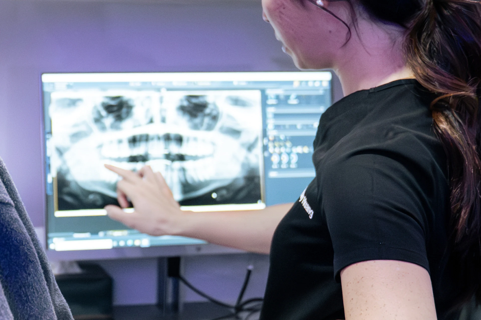 Digital X Rays