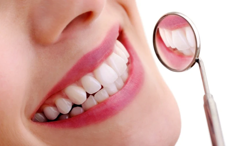 The Dental Beauty Ideal Is Becoming Increasingly And Freakishly Too Perfect